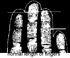 finger length