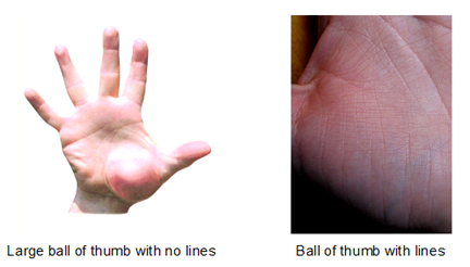 Large ball of thumb with and without lines